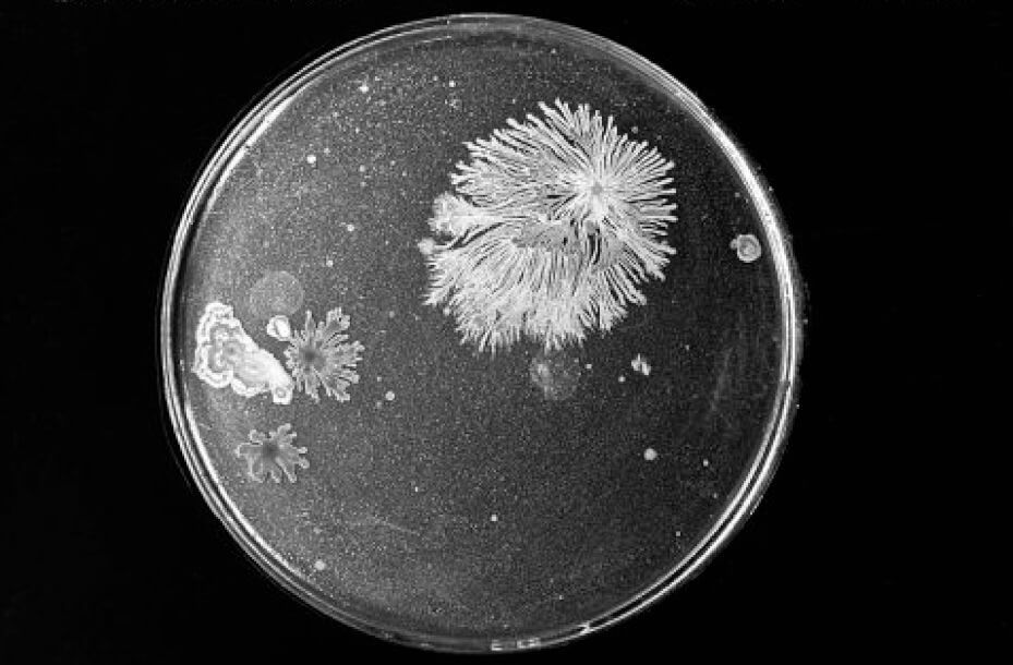 Black and white image showing a petri dish with bacteria growing on the medium.